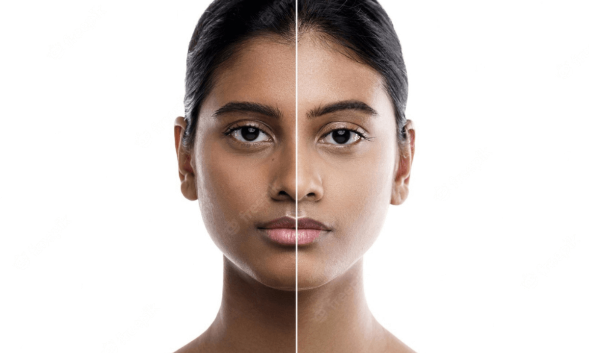 Achieving a Brighter Complexion: How to Safely Lighten and Brighten Your  Skin with Skin Bleaching - The Youth Fountain