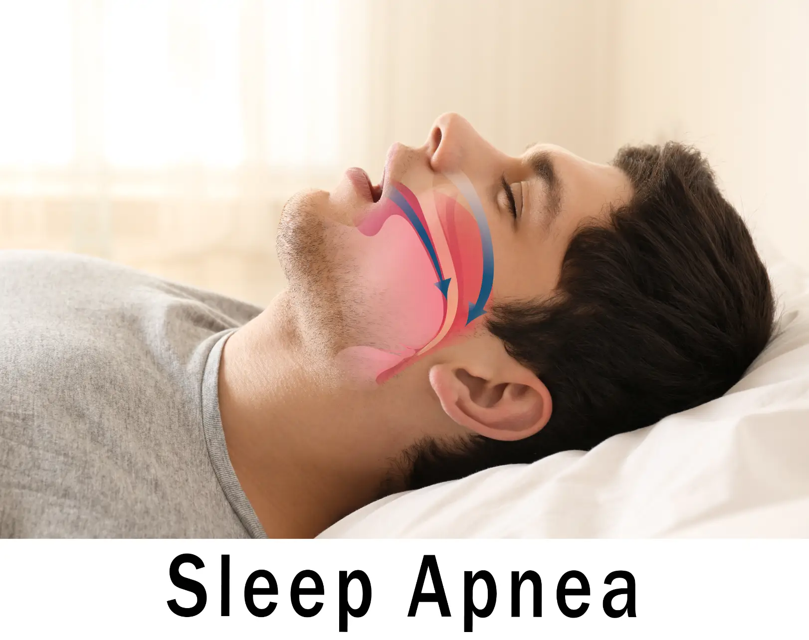Man sleeps on his back with colored graphics showing airflow through his nose and throat.